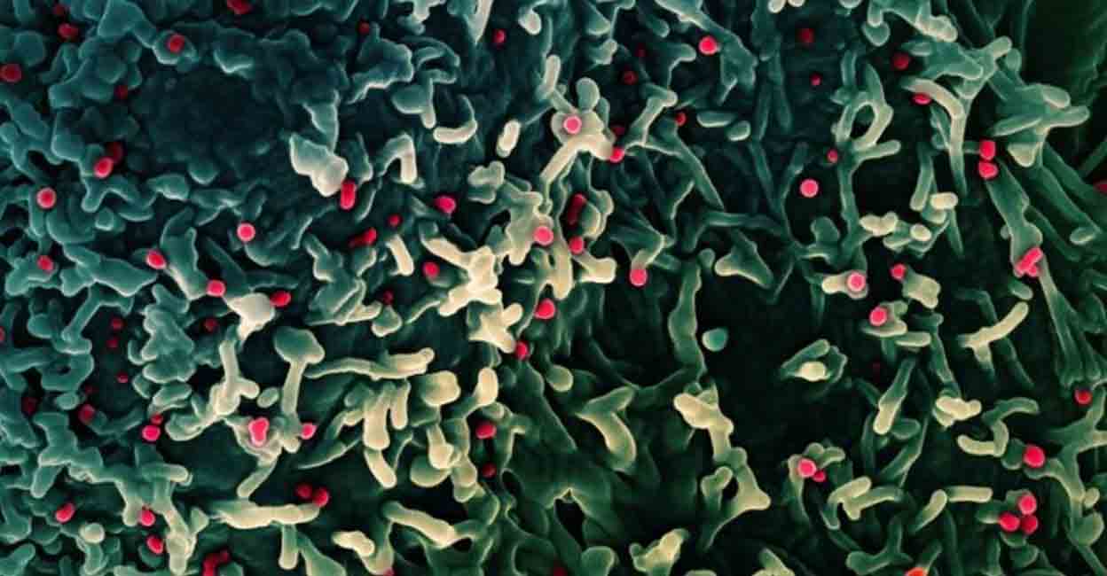 An undated colorized scanning electron micrograph of mpox virus (red) on the surface of infected VERO E6 cells (green). NIAID/Handout via REUTERS